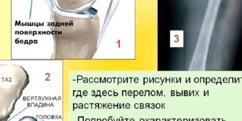 �� ��������� ����� ��� �������?